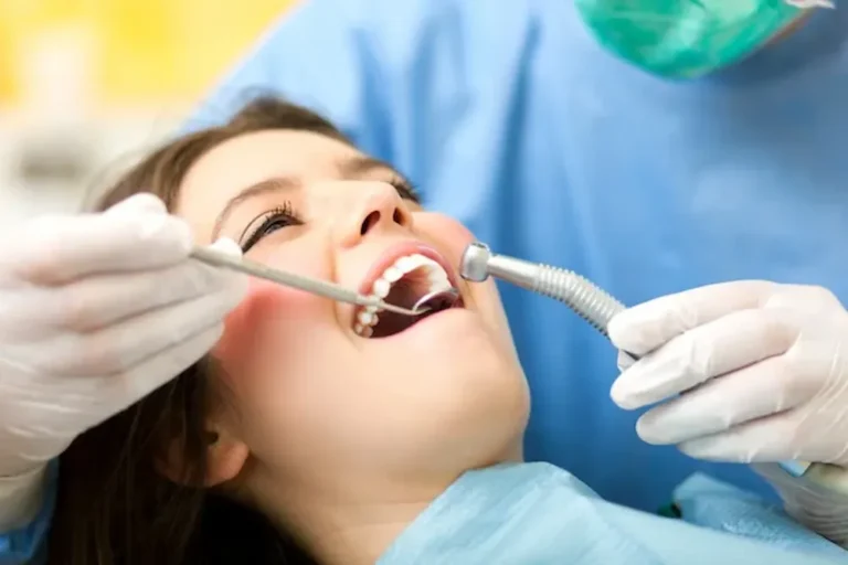 Caries dentales qué es y cómo prevenirla