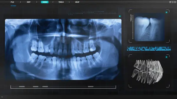 Tendencias en imagenología dental para 2025