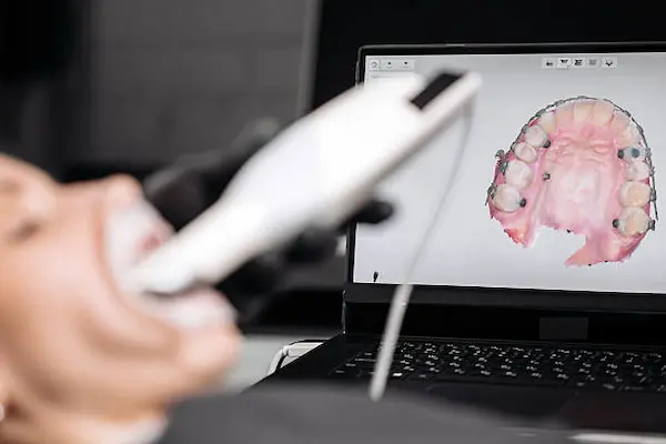 Diagnóstico bucal asistido por inteligencia artificial
