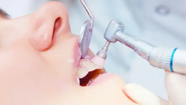 Beneficios de mantener una buena higiene bucal