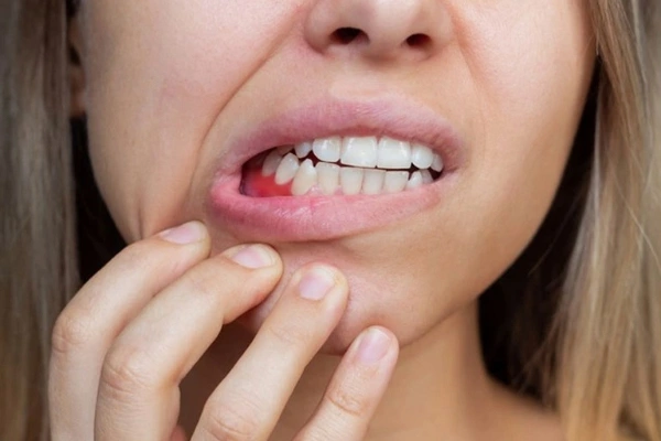 Cómo prevenir que las encías se sigan retrayendo