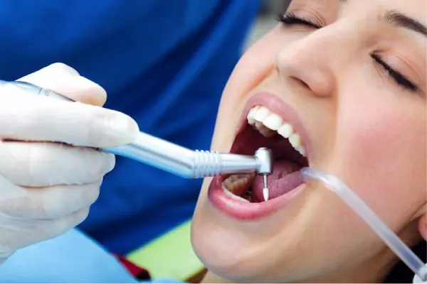 Errores comunes que afectan la higiene dental