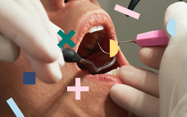 ¿Por qué es tan importante mantener una buena higiene oral?