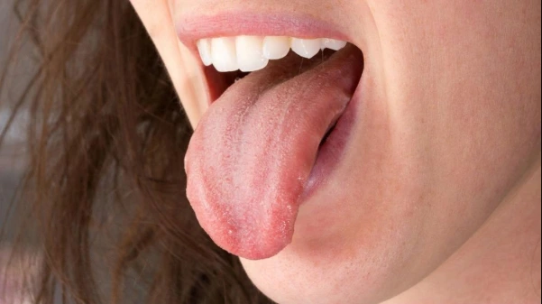 Cómo limpiar la lengua correctamente