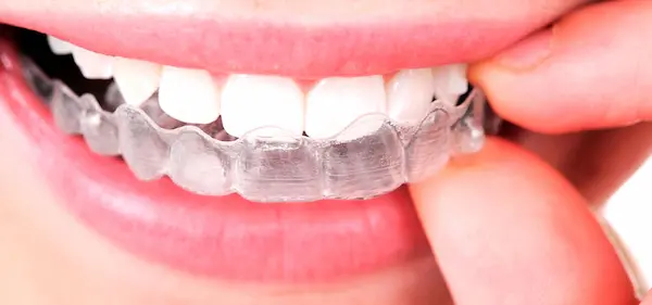 Dentistas Alcántara