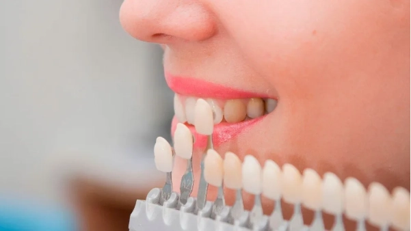 Enfermedades comunes que afectan los dientes