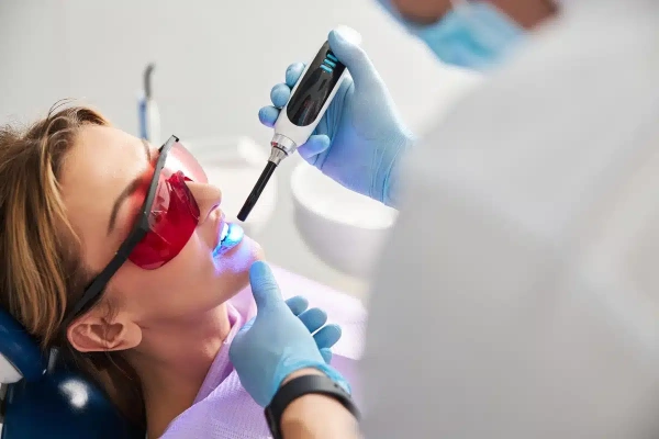¿Cuánto duran los sellantes dentales?