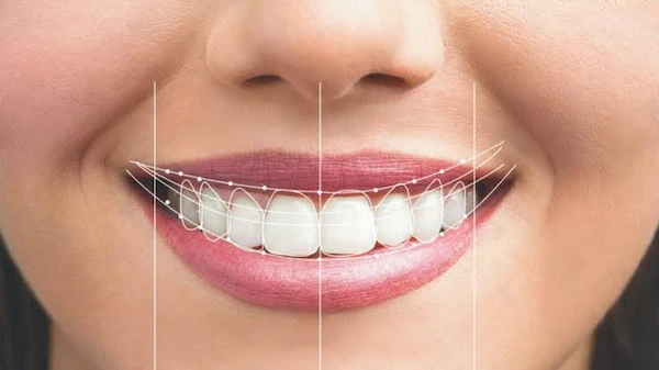 Clínica Diseño de Sonrisas